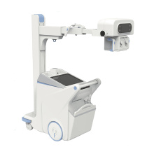 Hochfrequenz mobiles digitales Radiographie-System tragbarer Röntgenaufnahmen